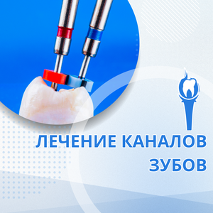 Лечение каналов зубов