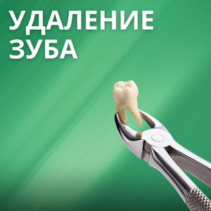 Удаление зуба от