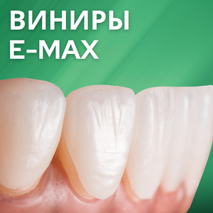 Виниры от 