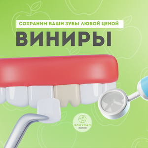 Виниры