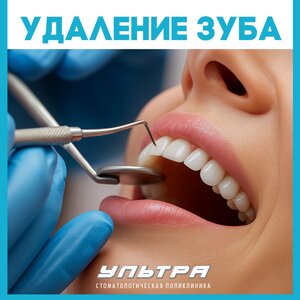 Удаление зуба от