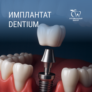 Имплантат Dentium от