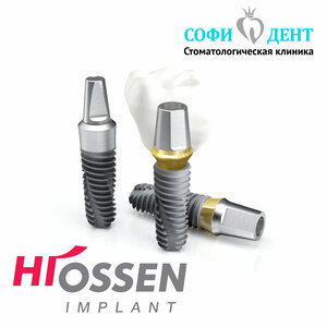 Установка имплантата «Hiossen» (США)