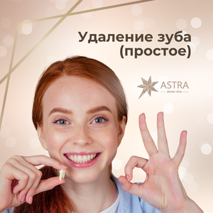 Удаление зуба (простое)