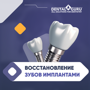 Имплантация