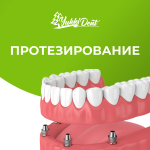 Протезирование