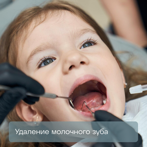Удаление молочного зуба