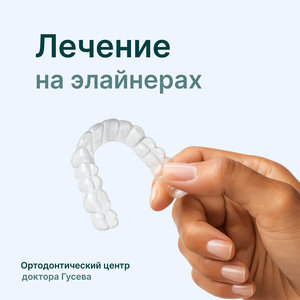 Лечение на элайнерах.