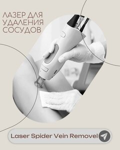 Удаление сосудов лазером