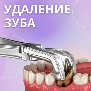 Удаление зуба от