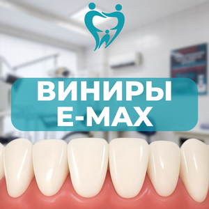 Виниры