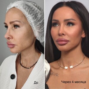 4 этапа современной реконструктивной косметологии