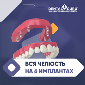 Протезирование на 6
