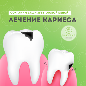 Лечение кариеса