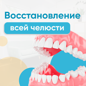 Имплантация All-on-4