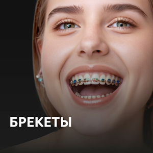 Современные брекет-системы