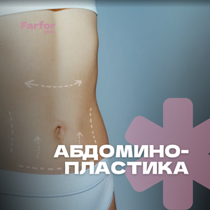 Абдоминопластика 