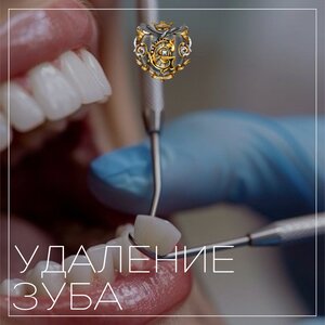 Удаление зуба от