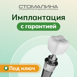 Имплантация зуба