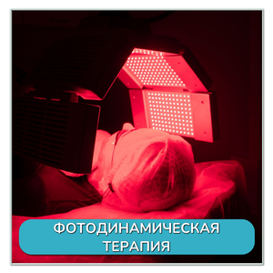 Фотодинамическая терапия