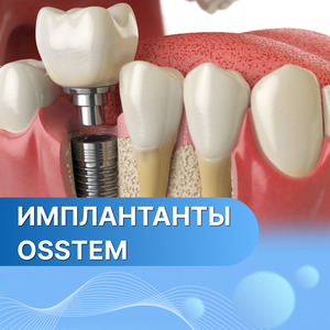 Имплантанты OSSTEM