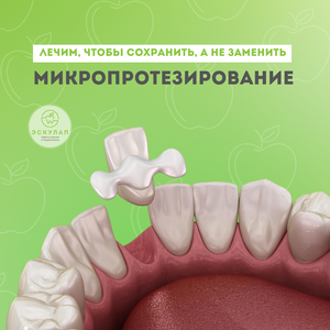 Микропротезирование зубов
