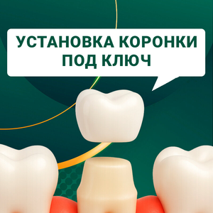 Установка коронки "под ключ"
