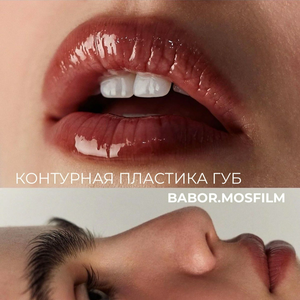 Контурная пластика губ