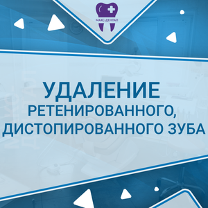 Удаление ретенированного, дистопированного зуба - от