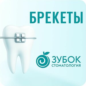 Брекеты Преображенская площадь