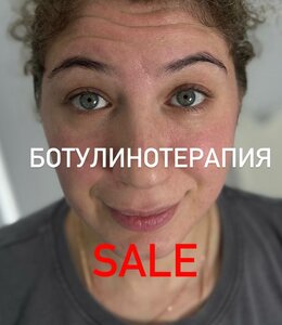 BOTOX