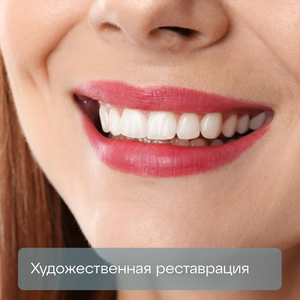 Художественная реставрация