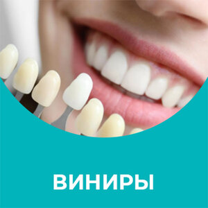 Виниры