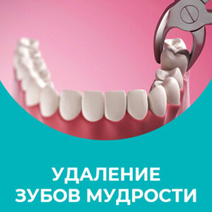 Удаление зубов мудрости