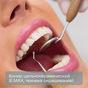 Винир цельнокерамический (E.MAX, техника окрашивание) 
