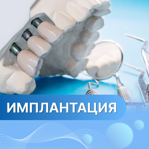 Имплантация