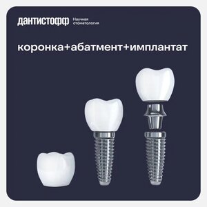 Имплантация Straumann с циркониевой коронкой «под ключ»