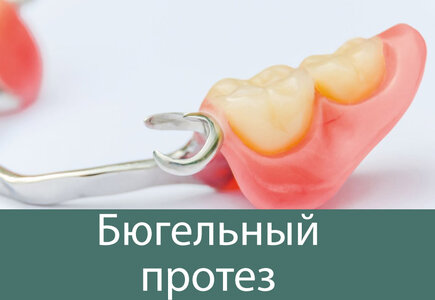 Бюгельные протезы