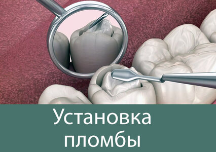 Поставить пломбу