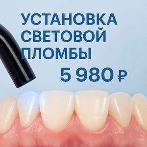 Установка световой пломбы