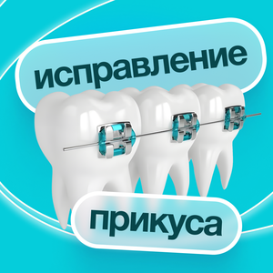 Ортодонтическое лечение с использованием брекет- системы