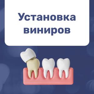 Реставрация зубов винирами