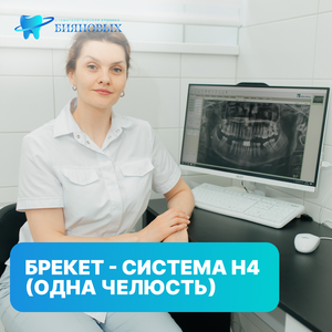 Брекет - система Н4 (одна челюсть)