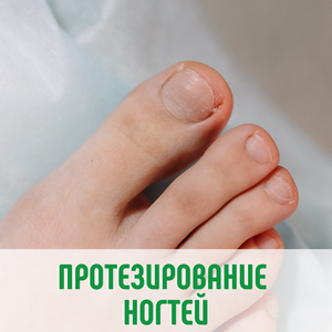 Протезирование ногтей, 1 ноготь