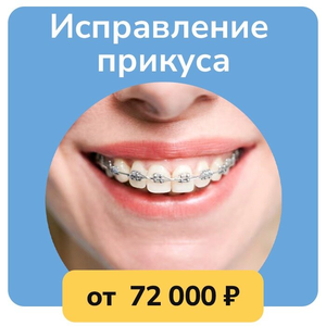 Брекеты