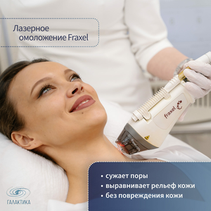 Лазерное омоложение «Фраксель»
