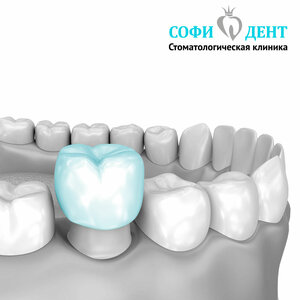 Цифровые керамические и цирконевые 3D коронки