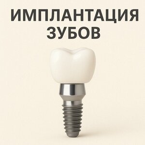 Имплантация зубов с пожизненной гарантией 