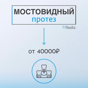 Мостовидный протез от 40000