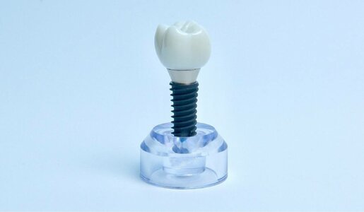 Установка имплантата Dentis c цельноциркониевой коронкой